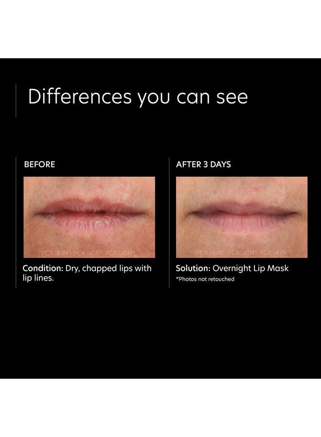 PCA SKIN قناع بلسم الشفاه الليلي — علاج العناية بالبشرة للشفاه المرطبة للغاية، يستعيد الرطوبة ويرطب الشفاه الجافة والمتشققة أثناء النوم (0.46 أونصة) - Image 4